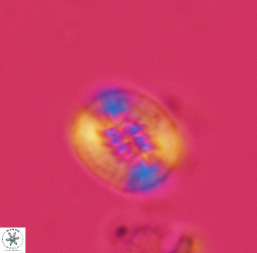 Retecapsa ficula 3248