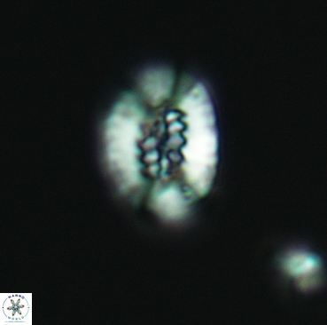 Retecapsa ficula 3361