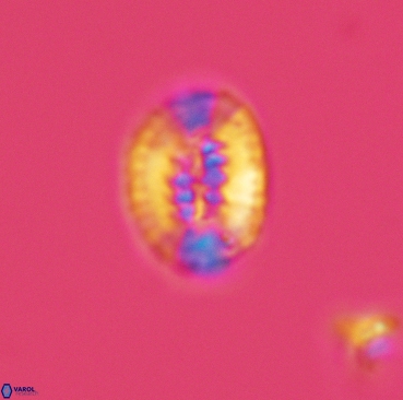 Retecapsa ficula 3362