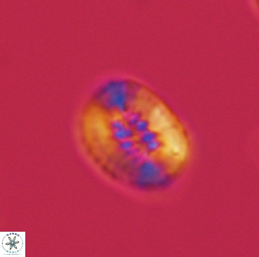 Retecapsa ficula 3363
