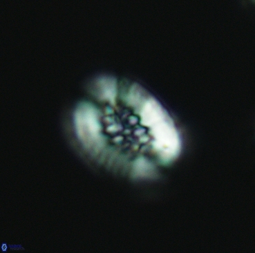 Retecapsa ficula 3364