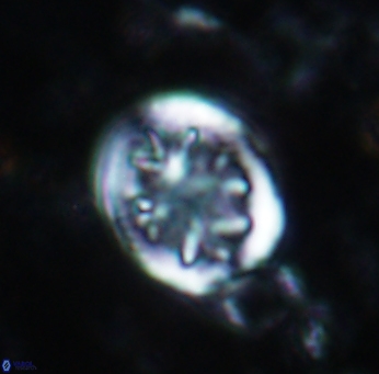 Retecapsa schizobrachiata 1757