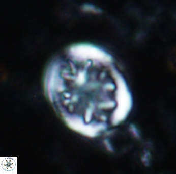 Retecapsa schizobrachiata 1757