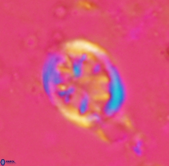 Retecapsa schizobrachiata 1758