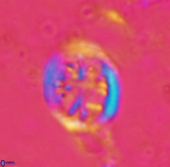 Retecapsa schizobrachiata 1760