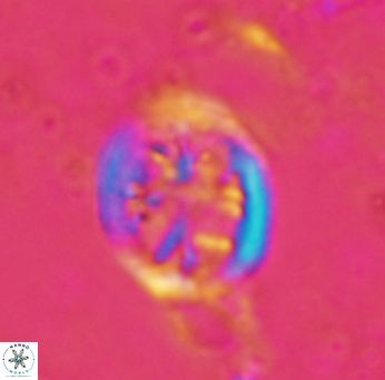 Retecapsa schizobrachiata 1760
