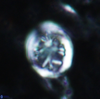 Retecapsa schizobrachiata 1761