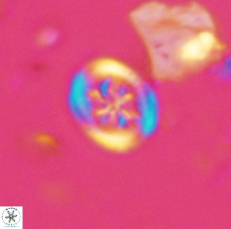 Retecapsa schizobrachiata 38379