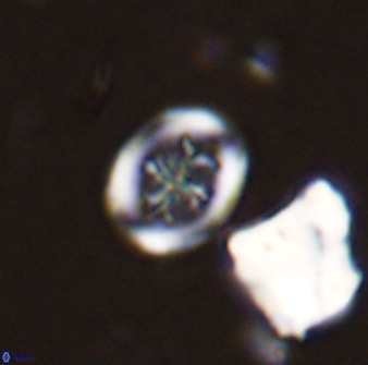 Retecapsa schizobrachiata 38384