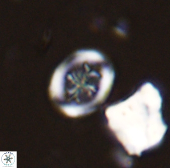Retecapsa schizobrachiata 38384