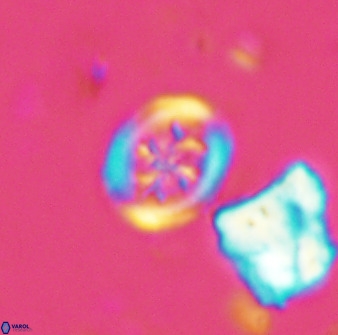 Retecapsa schizobrachiata 38385