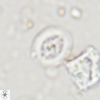 Retecapsa schizobrachiata 38386