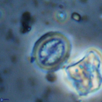 Retecapsa schizobrachiata 38387