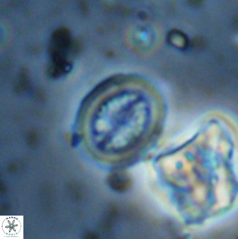 Retecapsa schizobrachiata 38387