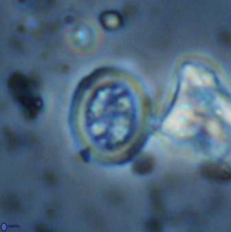 Retecapsa schizobrachiata 38388