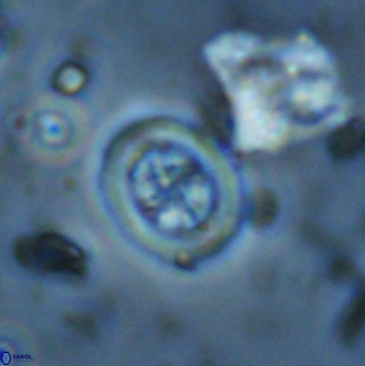 Retecapsa schizobrachiata 38389