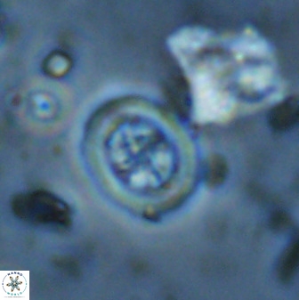 Retecapsa schizobrachiata 38389