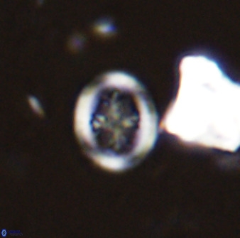 Retecapsa schizobrachiata 38380