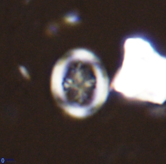 Retecapsa schizobrachiata 38382