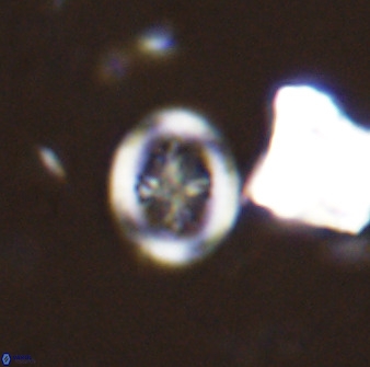 Retecapsa schizobrachiata 38383