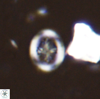 Retecapsa schizobrachiata 38383