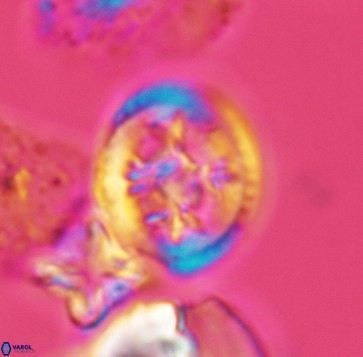 Retecapsa schizobrachiata 3239