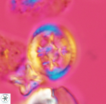 Retecapsa schizobrachiata 3239