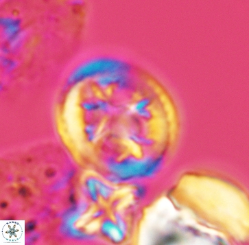 Retecapsa schizobrachiata 3241