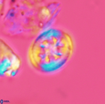 Retecapsa schizobrachiata 3259