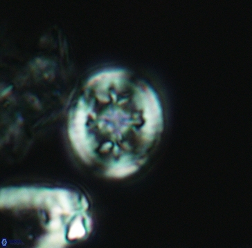 Retecapsa schizobrachiata 3260