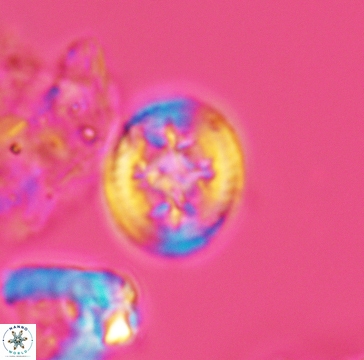 Retecapsa schizobrachiata 3261