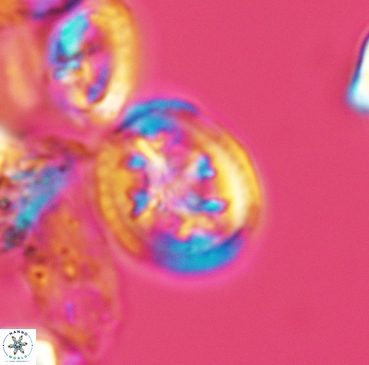 Retecapsa schizobrachiata 3358