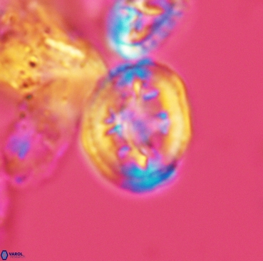 Retecapsa schizobrachiata 3360