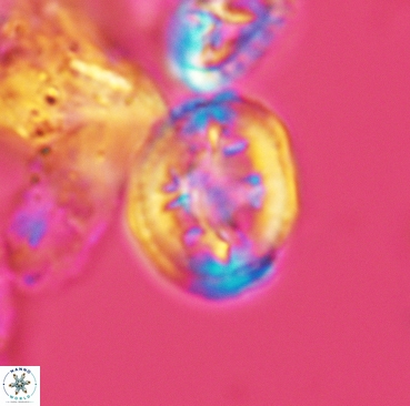 Retecapsa schizobrachiata 3360