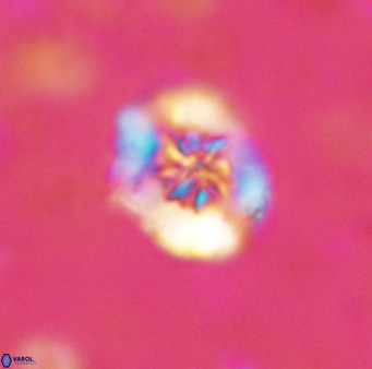 Retecapsa sinuosa 42544