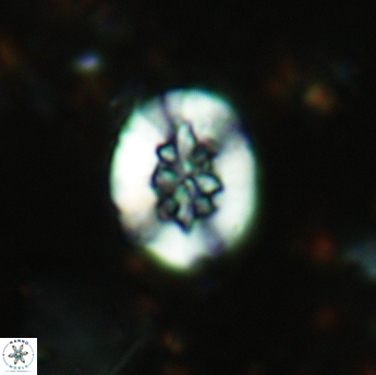 Retecapsa sinuosa 5537