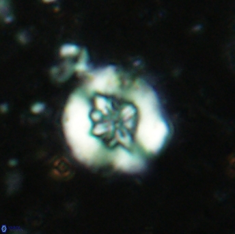 Retecapsa sinuosa 5604