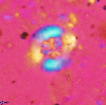 Retecapsa sinuosa 5609