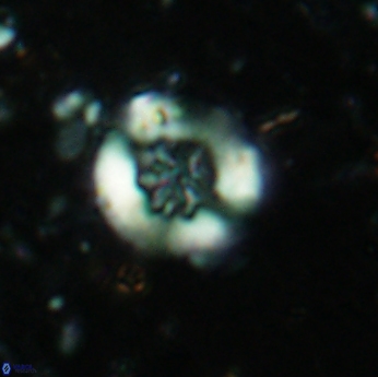 Retecapsa sinuosa 5610