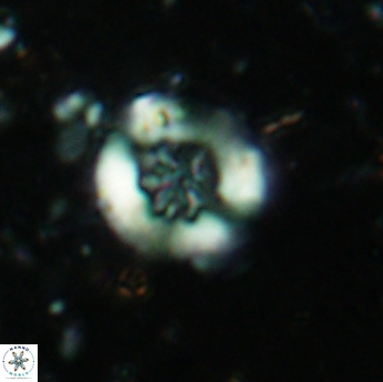 Retecapsa sinuosa 5610