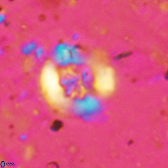 Retecapsa sinuosa 5611