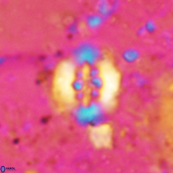 Retecapsa sinuosa 5771