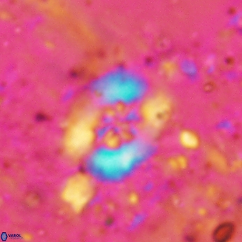 Retecapsa sinuosa 5773