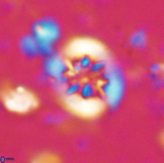 Retecapsa sinuosa 13890