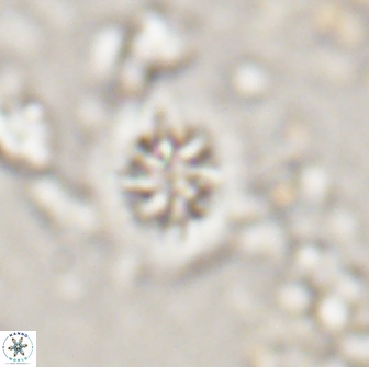Retecapsa sinuosa 13895