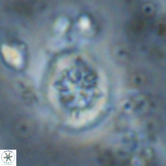 Retecapsa sinuosa 13896