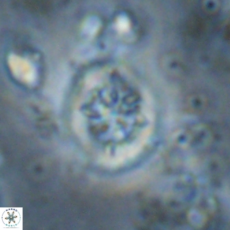 Retecapsa sinuosa 13897