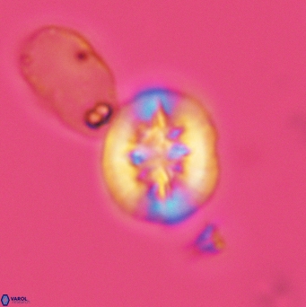 Retecapsa sinuosa 3442