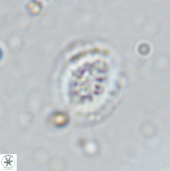 Retecapsa sinuosa 34525
