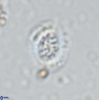 Retecapsa sinuosa 34526